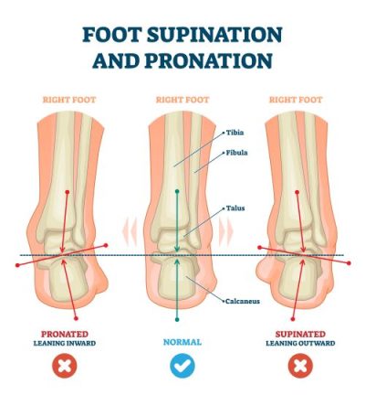 The Meaning and Types of Pronation - Run Just For Fun