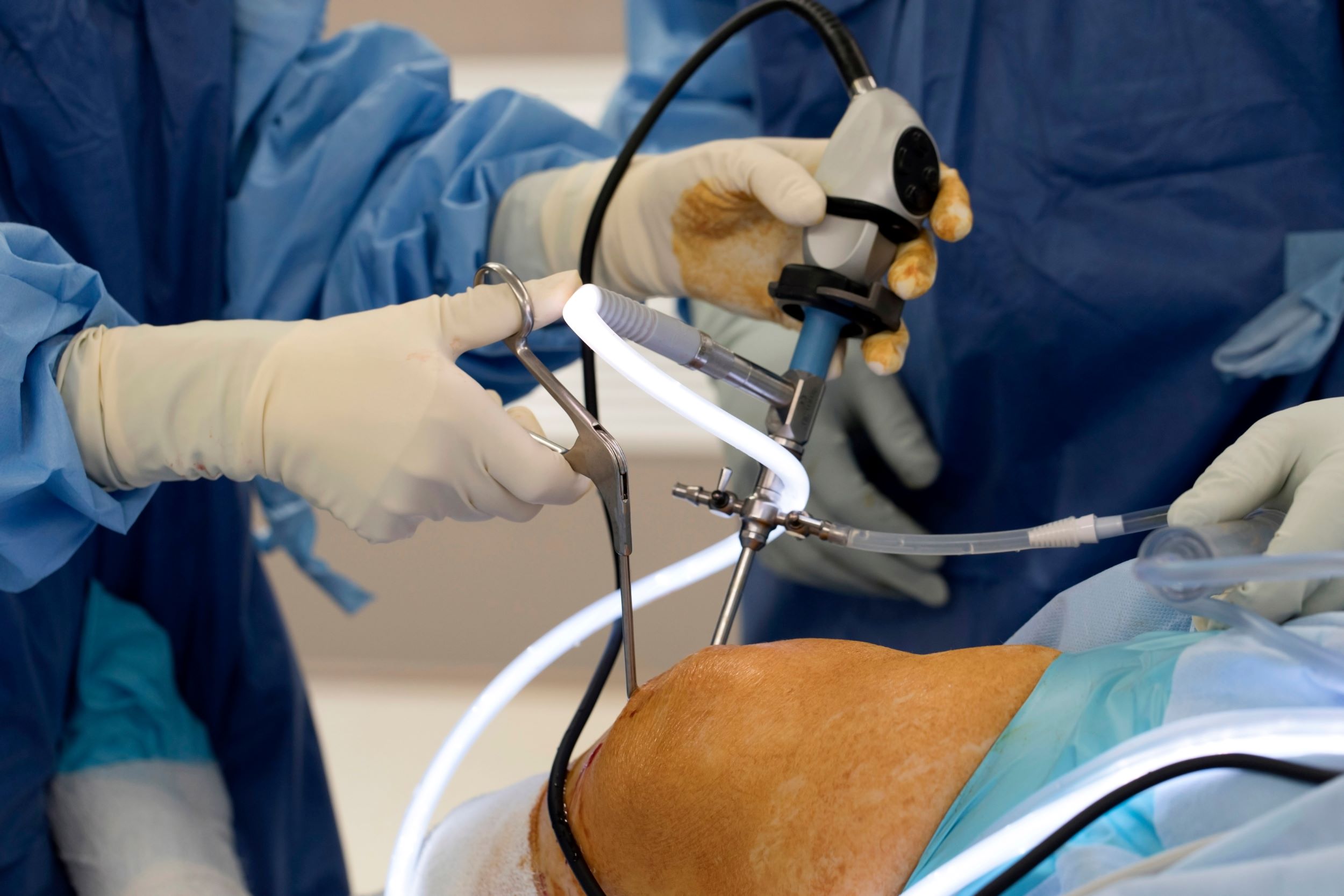 A group of surgeons working on a patient.